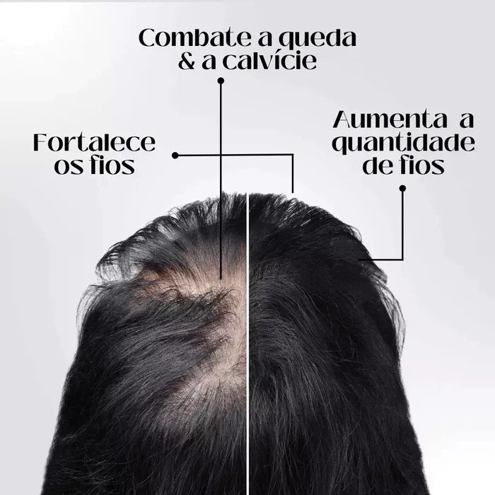 Diminui Queda 95% Aumenta Crescimento 20x  | Repair Hair