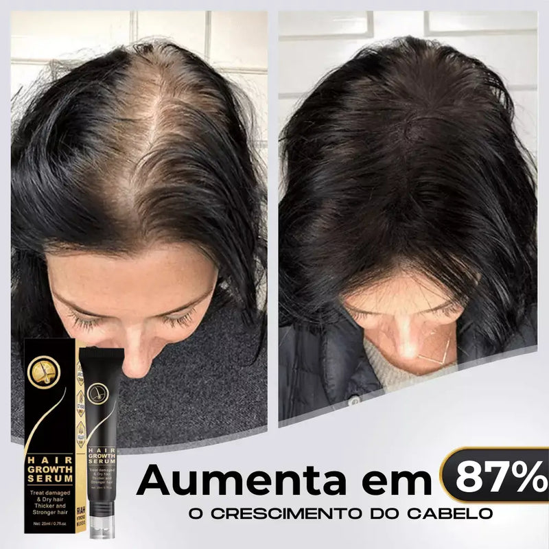 Diminui Queda 95% Aumenta Crescimento 20x  | Repair Hair