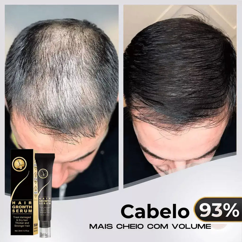 Diminui Queda 95% Aumenta Crescimento 20x  | Repair Hair